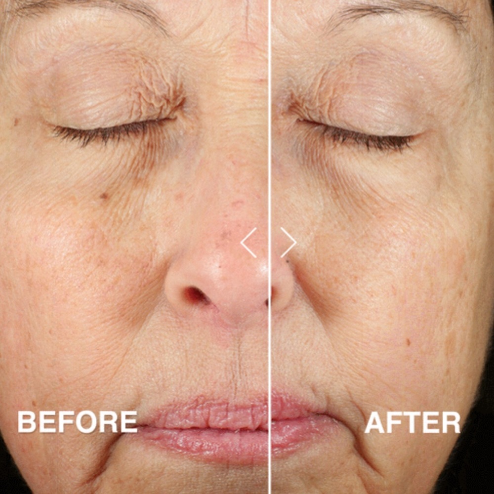 LAST 1! Derma E Anti-Aging Regenerative Day Cream Moisturizer 🪞 NEW - Picture 4 of 7